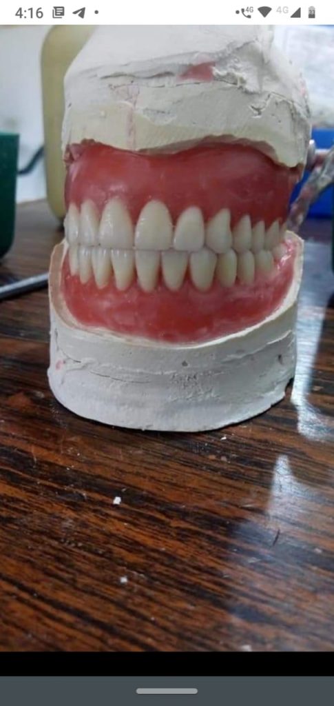 laboratorio dental